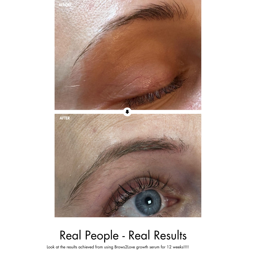 Brows2Love Growth Serum