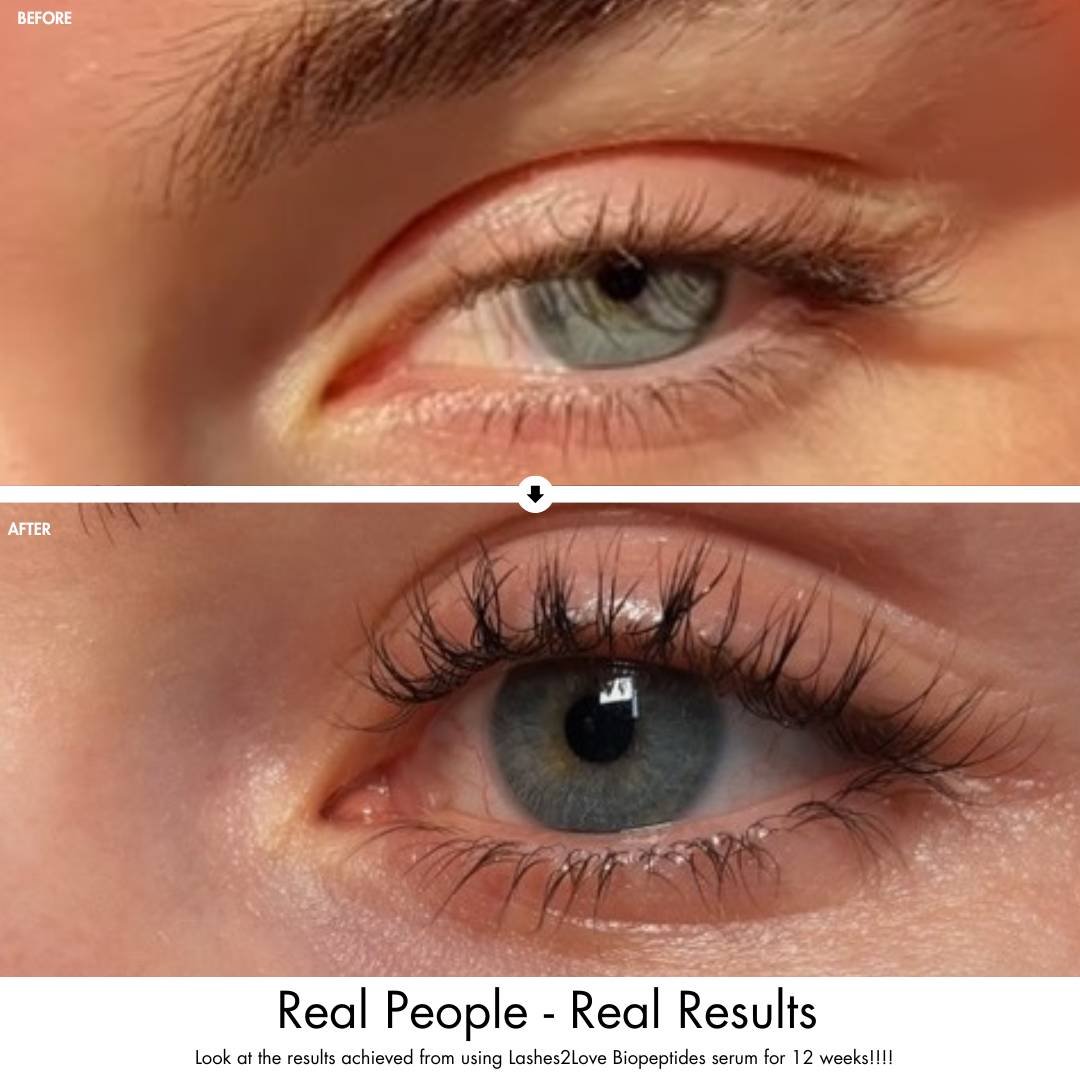 Lashes2Love Biopeptides Lash Growth Serum  Gentle Formula with Plant-Derived Ingredients