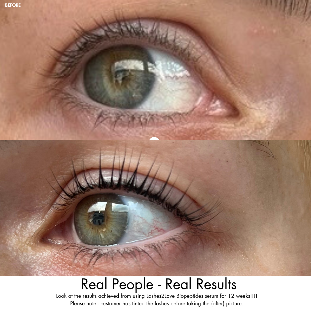 Lashes2Love Biopeptides Lash Growth Serum  Gentle Formula with Plant-Derived Ingredients