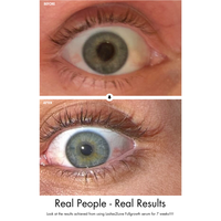 Lashes2Love Lash Growth Serum - Advanced Growth Formula