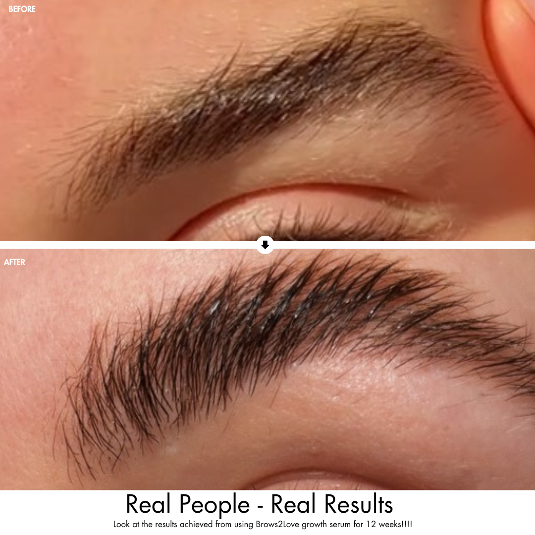 Brows2Love Growth Serum