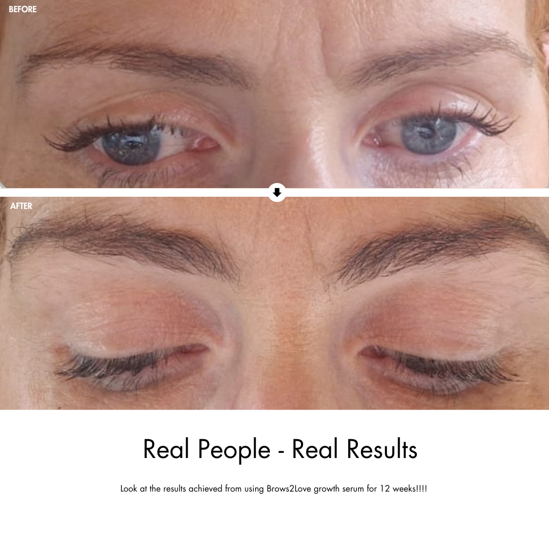 Brows2Love Growth Serum