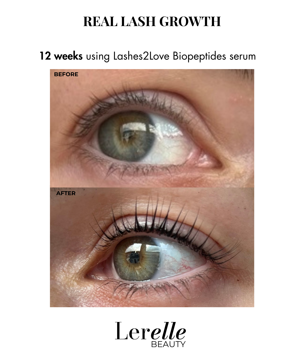 Before and after comparison of eye lashes using Lashes2Love Biopeptides serum by Lerelle Beauty.