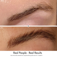 Before and after comparison of eyebrows with text 'Real People - Real Results'.