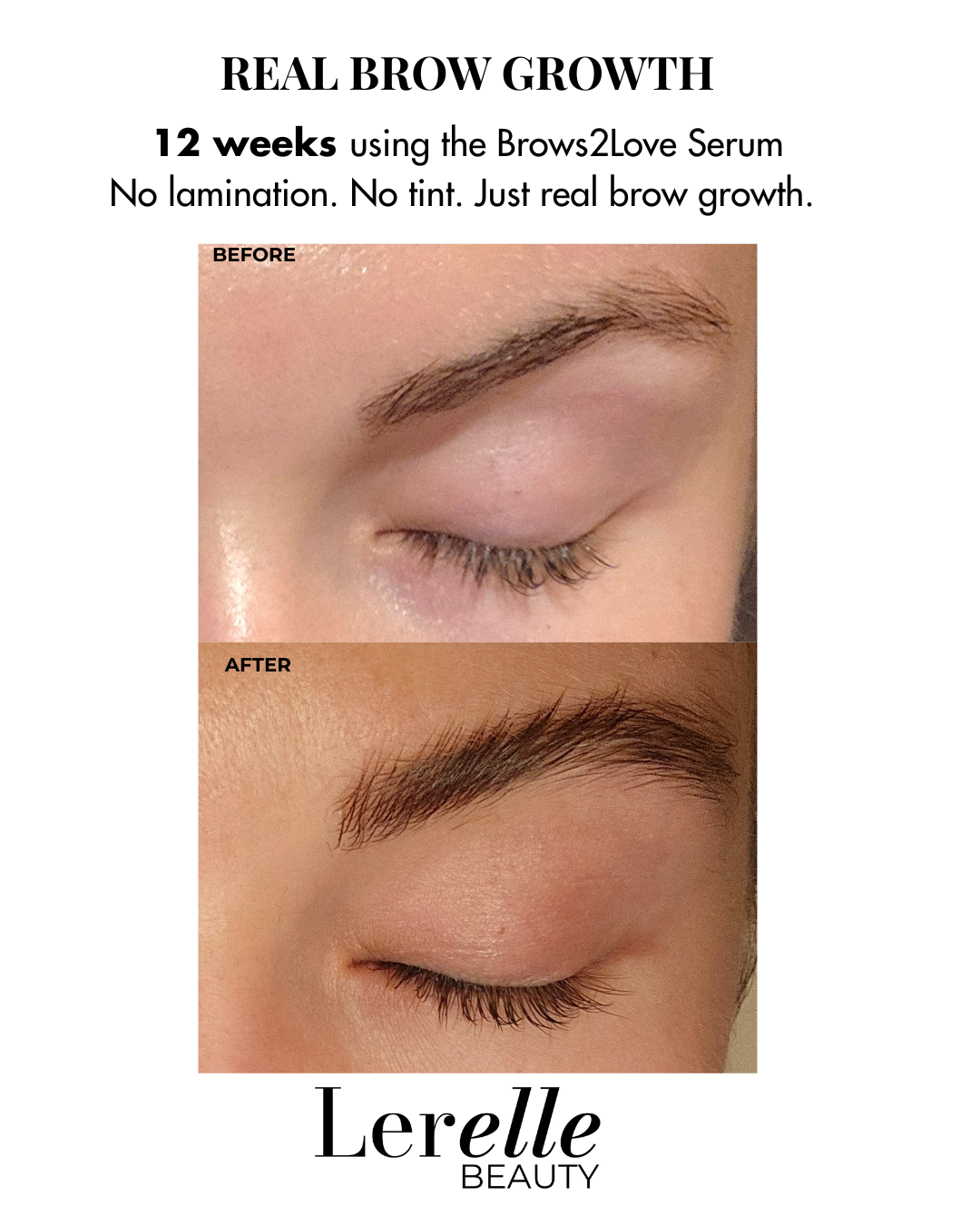 Before and after comparison of eyebrows using Brows2Love Serum by Lerelle Beauty.