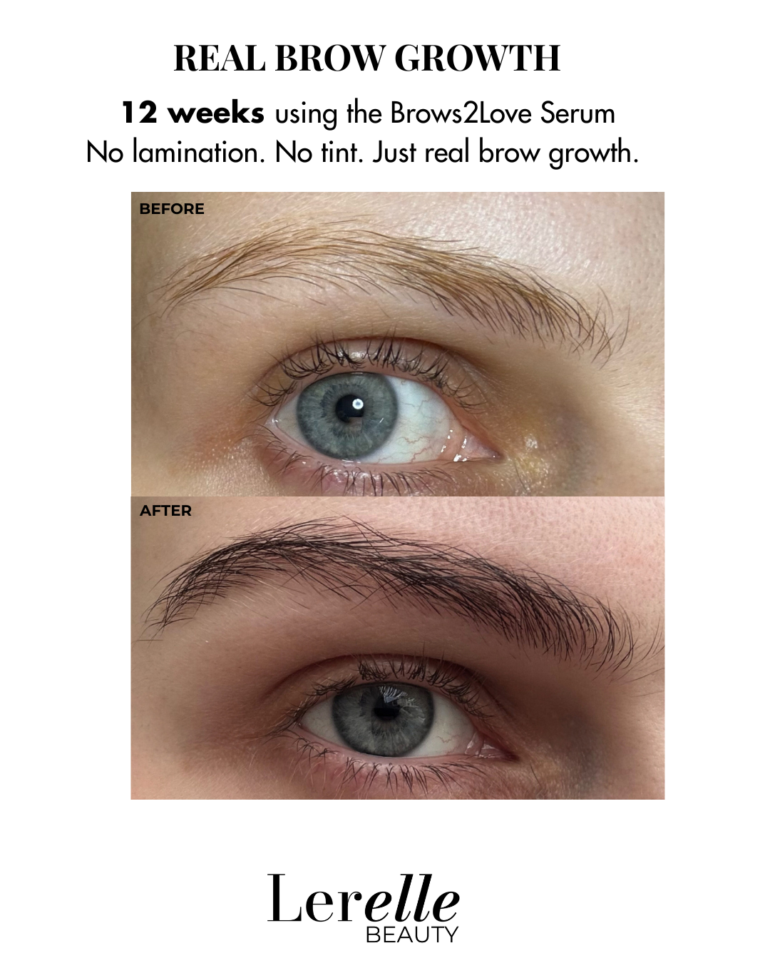 Before and after comparison of eye brows using Brows2Love Serum by Lerelle Beauty.