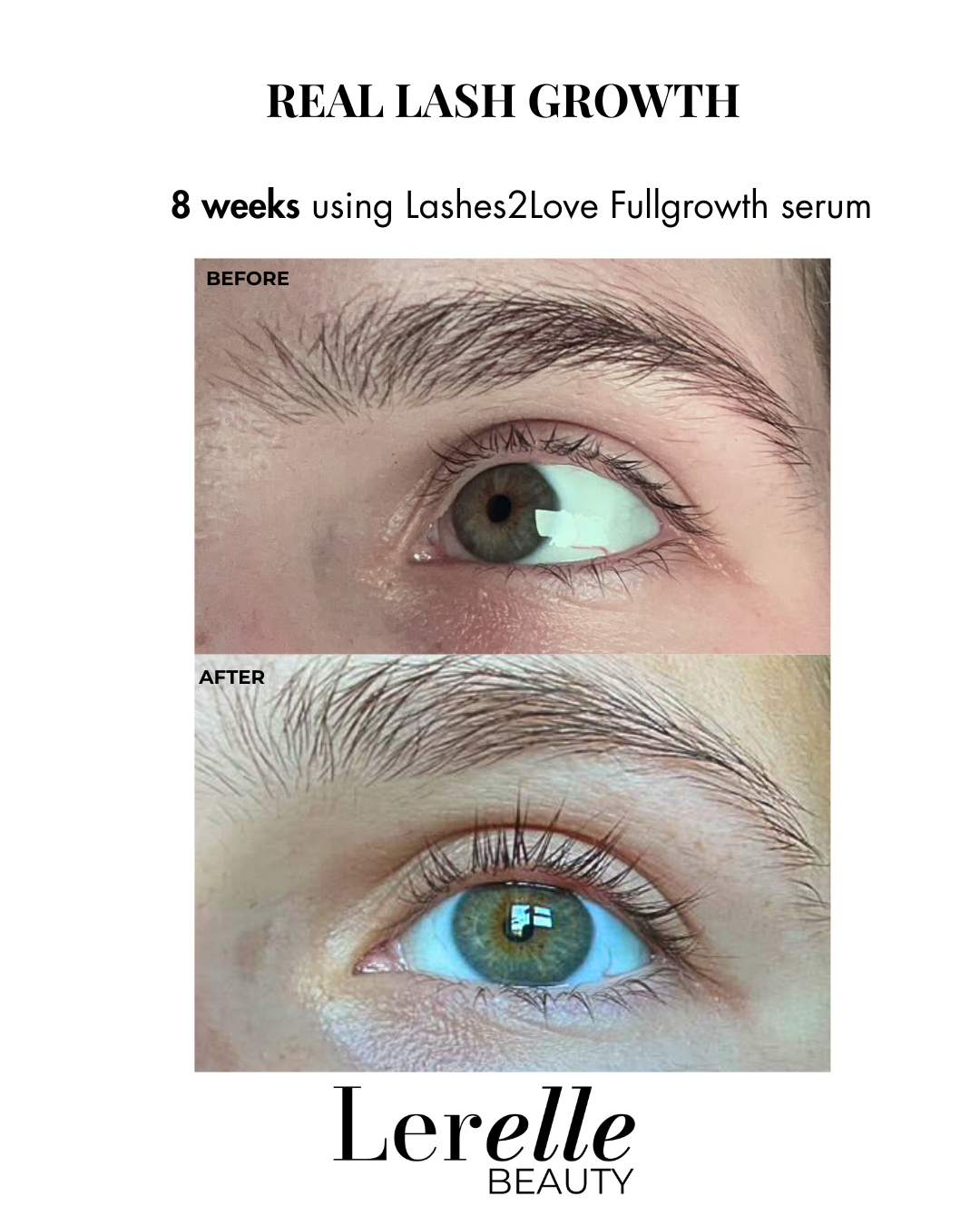 Lash & Brow Growth Journey Bundle