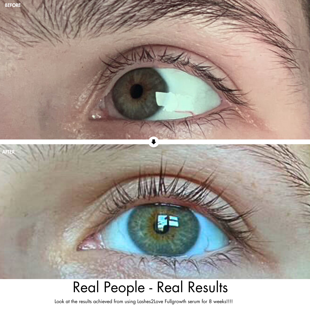 Before and after comparison of an eye with LashLove serum showing growth.