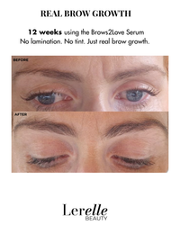 Full EyeCare Bundle