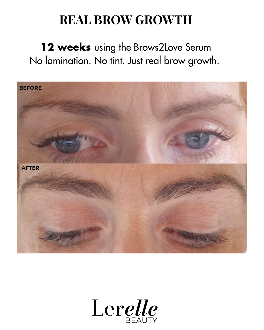 Full EyeCare Bundle