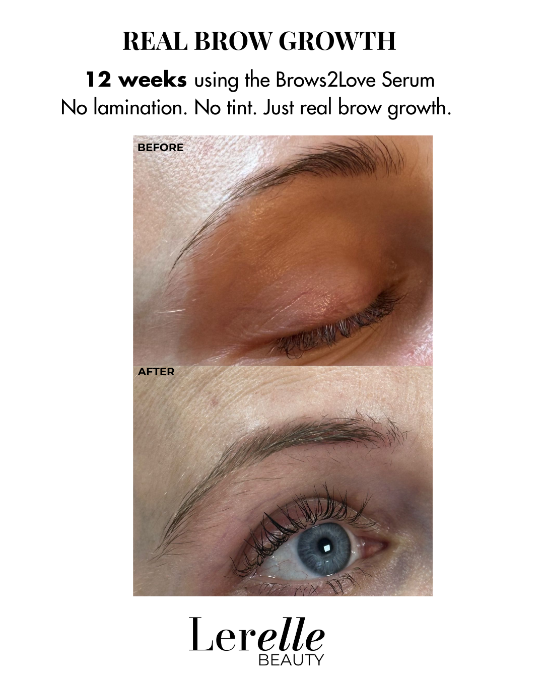 Full EyeCare Bundle