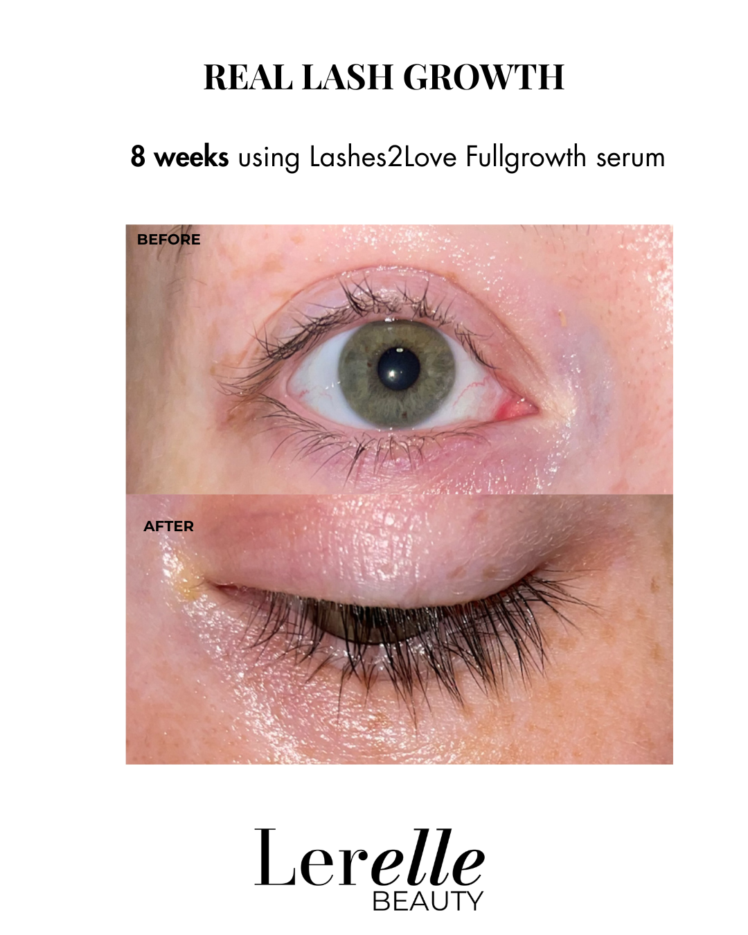 Before and after comparison of eye lashes using Lashes2Love Fullgrowth serum by Lerelle Beauty.