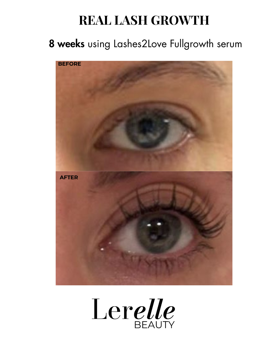 Before and after comparison of eye lashes using Lashes2Love Fullgrowth serum by Lerelle Beauty.