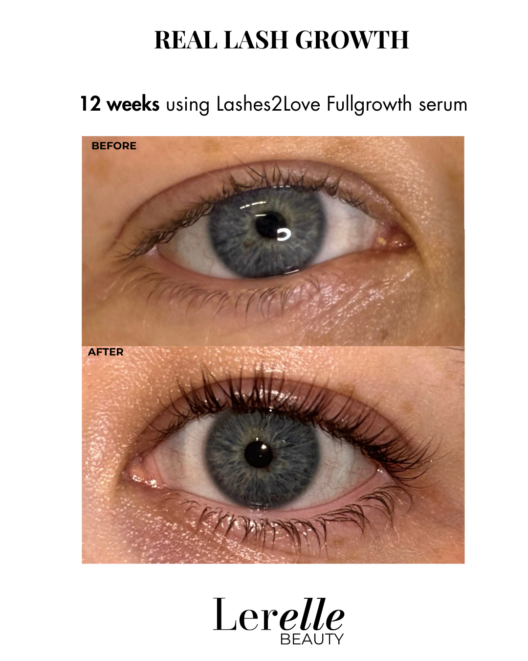 Before and after comparison of eye lashes using Lashes2Love Fullgrowth serum by Lerelle Beauty.