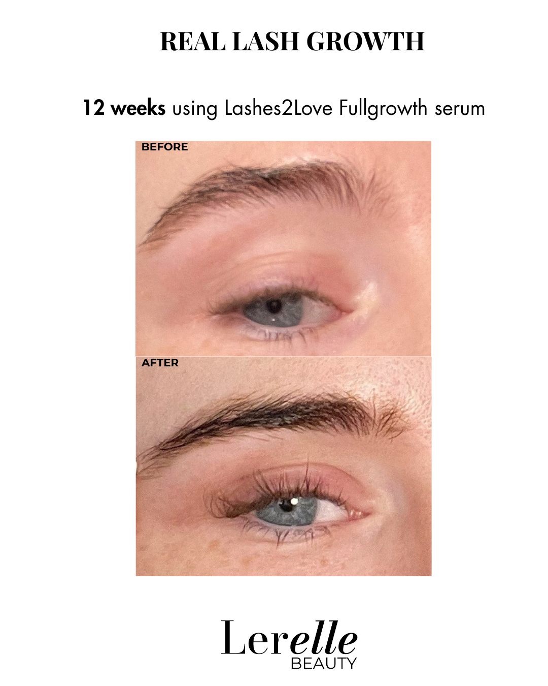Before and after comparison of eye lash growth using Lashes2Love Fullgrowth serum by Lerelle Beauty.