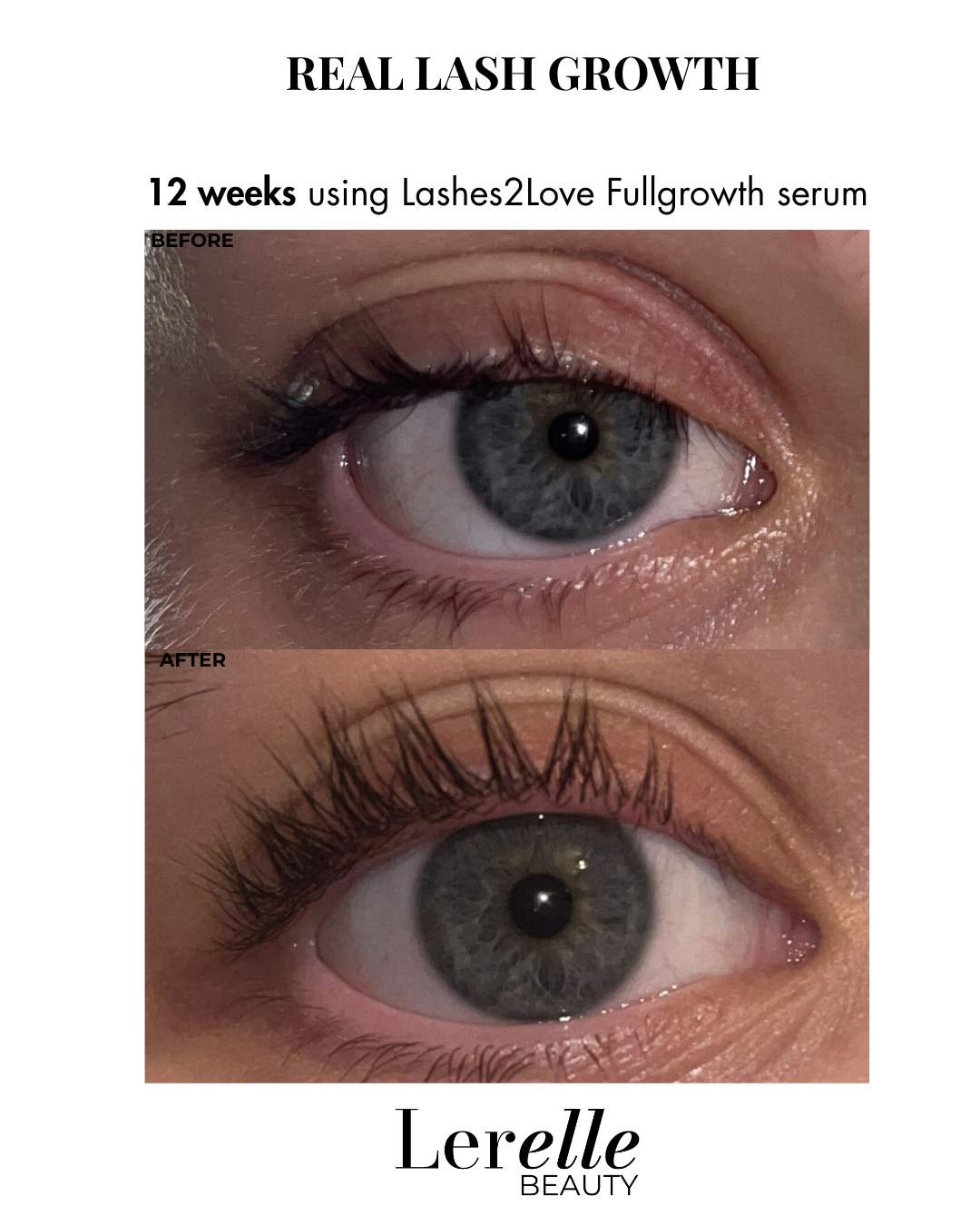 Before and after comparison of eye lashes using Lashes2Love Fullgrowth serum by Lerelle Beauty.