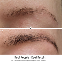 Before and after comparison of eyebrow growth using a serum, with text 'Real People - Real Results'.
