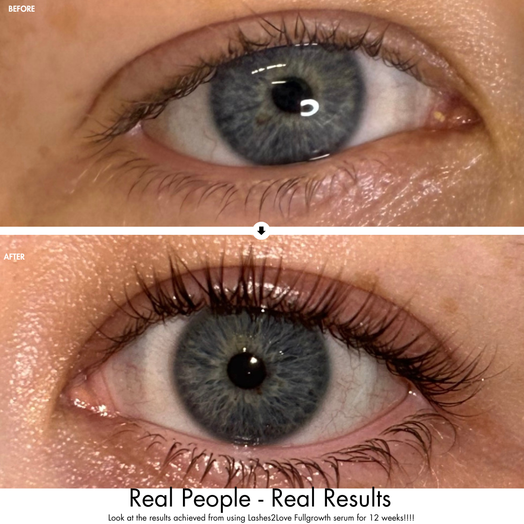 Before and after comparison growing eyelashes.